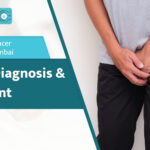Top Prostate Cancer Specialist in Mumbai