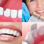 Permanent Dentures odessa