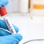 How Does a Vitamin D Blood Test Work?