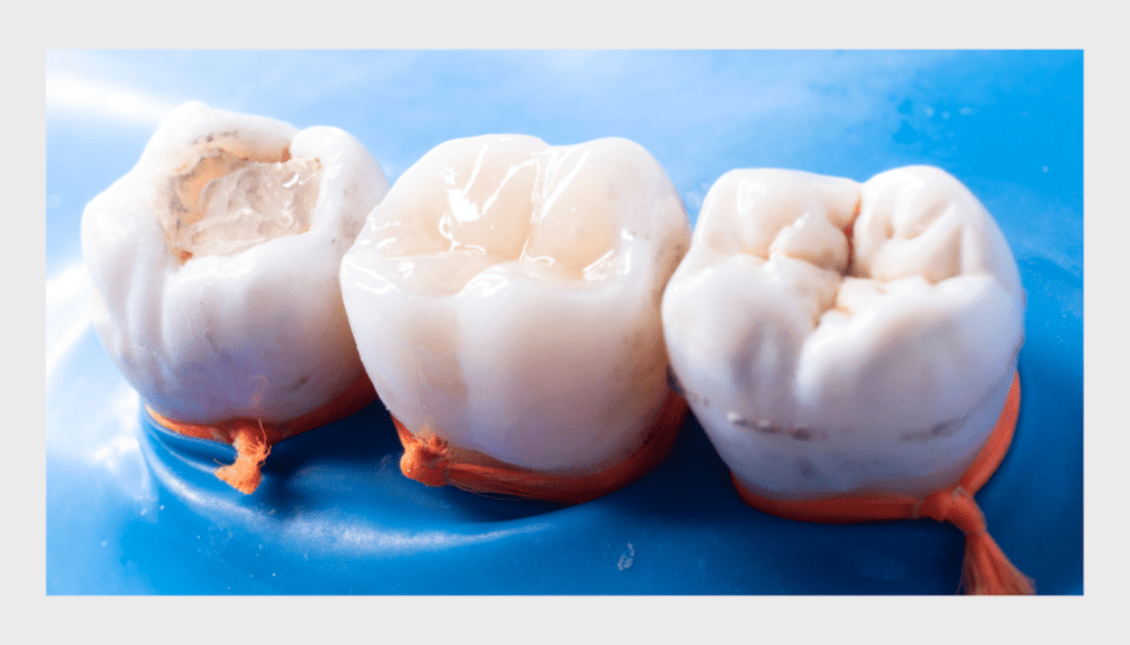 Same Day Fillings