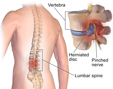 In the aftermath of surgery or a serious injury, pain can significantly hinder the recovery process. It can restrict movement, delay healing, disrupt sleep, and negatively impact a person’s quality of life.