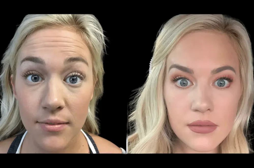 Why First-Time Clients Trust the Best Plastic Surgeons in dubai for Botox