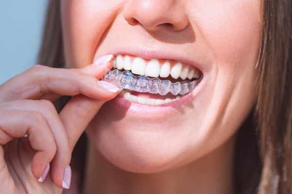 Invisalign Blackburn