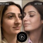Trusted by Celebrities: Best Plastic Surgeons in Dubai