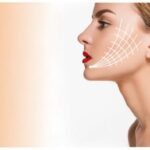 Best Doctors in Dubai for Thread Lift The Ultimate Non-Surgical Solution for Lifting and Tightening Skin