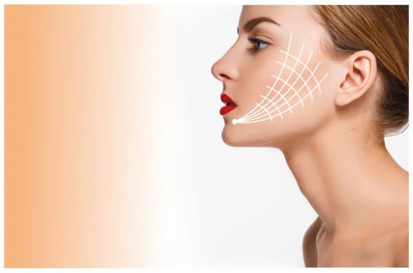 Best Doctors in Dubai for Thread Lift The Ultimate Non-Surgical Solution for Lifting and Tightening Skin