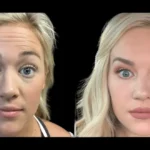 Top Skin Whitening Treatments at the Best Aesthetic Clinic in Dubai