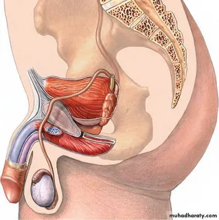No Scalpel Vasectomy: Recovery Timeline Explained