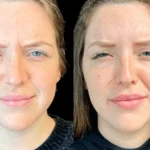 What Makes the Best Aesthetic Clinic in Dubai Stand Out from the Rest