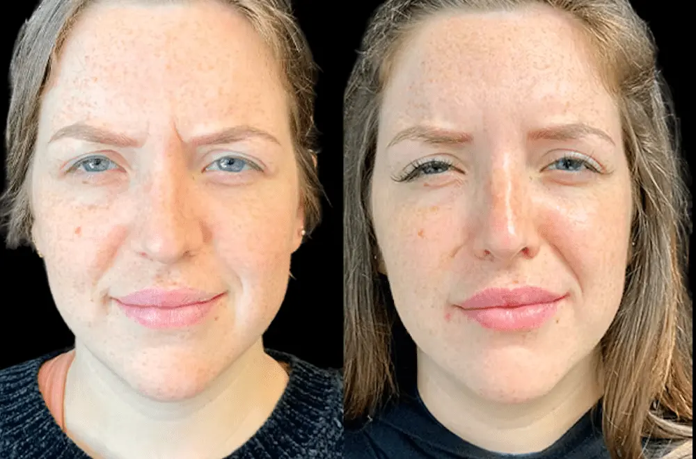 What Makes the Best Aesthetic Clinic in Dubai Stand Out from the Rest