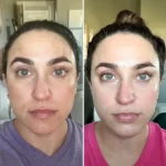 Perfect Skin Starts with the Best Plastic Surgeon in Dubai and Fotona 4D Laser in Dubai