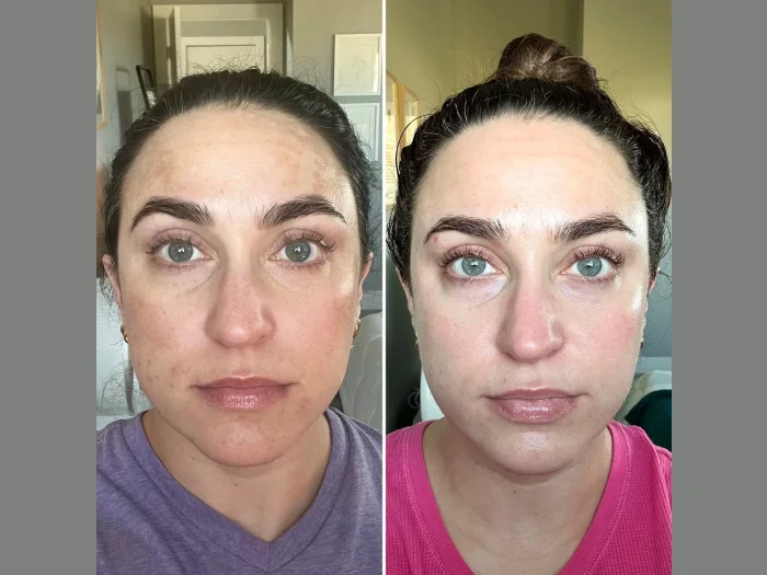 Perfect Skin Starts with the Best Plastic Surgeon in Dubai and Fotona 4D Laser in Dubai