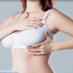 Breast Augmentation In Dubai