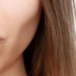 A Patient’s Guide to Choosing the Best Aesthetic Clinics in Dubai for Sculptra Fillers