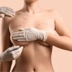Breast Enlargement Dubai Cost and Consultation Guide