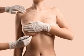 Breast Enlargement Dubai Cost and Consultation Guide